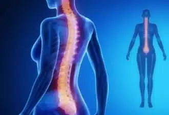 Colonne vertebrale IA