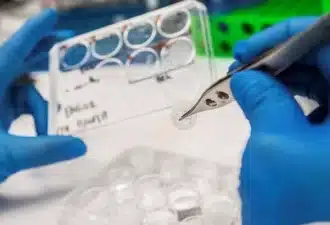 Nouveau traitement prometteur avec la thérapie cellulaire