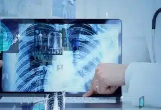 Forfait Innovation : accès précoce et encadré aux technologies de santé prometteuses