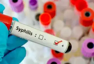 syphilis