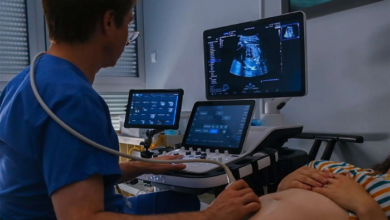 Samsung Medison rachète Sonio, une société d'échographie IA dédiée à la santé prénatale