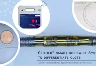 Clotild Smart Guidewire System