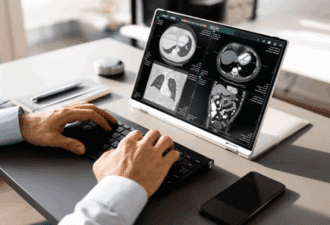 Radiologue rédigeant un compte rendu automatisé avec la solution Rayvolve d’AZmed intégrée au RIS