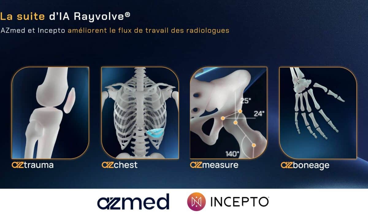 Suite d’IA Rayvolve d’AZmed intégrée sur la plateforme Incepto pour améliorer le flux de travail des radiologues, avec les modules AZtrauma, AZchest, AZmeasure et AZboneage.