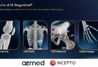Suite d’IA Rayvolve d’AZmed intégrée sur la plateforme Incepto pour améliorer le flux de travail des radiologues, avec les modules AZtrauma, AZchest, AZmeasure et AZboneage.