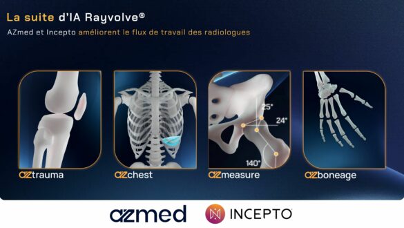Suite d’IA Rayvolve d’AZmed intégrée sur la plateforme Incepto pour améliorer le flux de travail des radiologues, avec les modules AZtrauma, AZchest, AZmeasure et AZboneage.